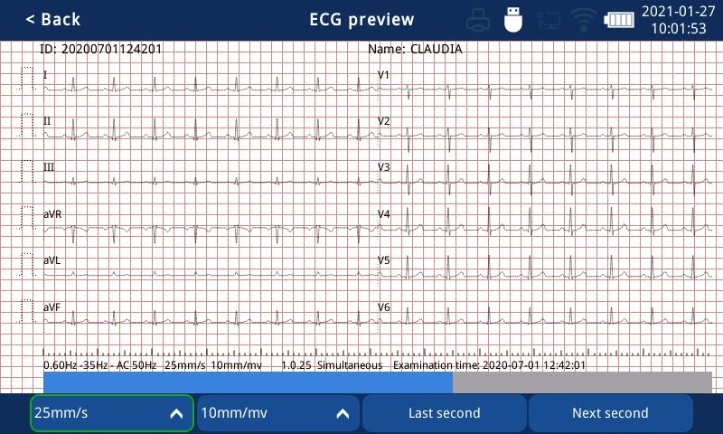 touch screen electrocardiograph machine