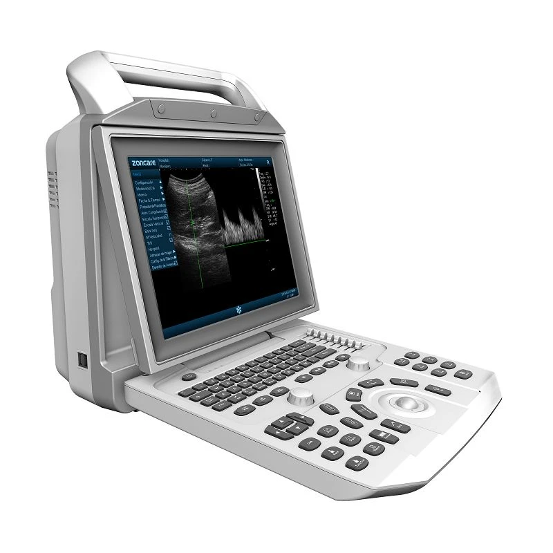 Portativ B&W Umumiy tasvir ultratovush